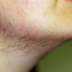 Illustration for article titled Excess Hair May Be A Sign Of Health Problems In Women